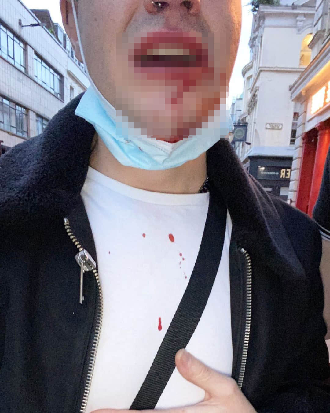 英国一周三起恐同袭击事件 利物浦犯罪委员会严正表示「不能接受」-NICEOLO