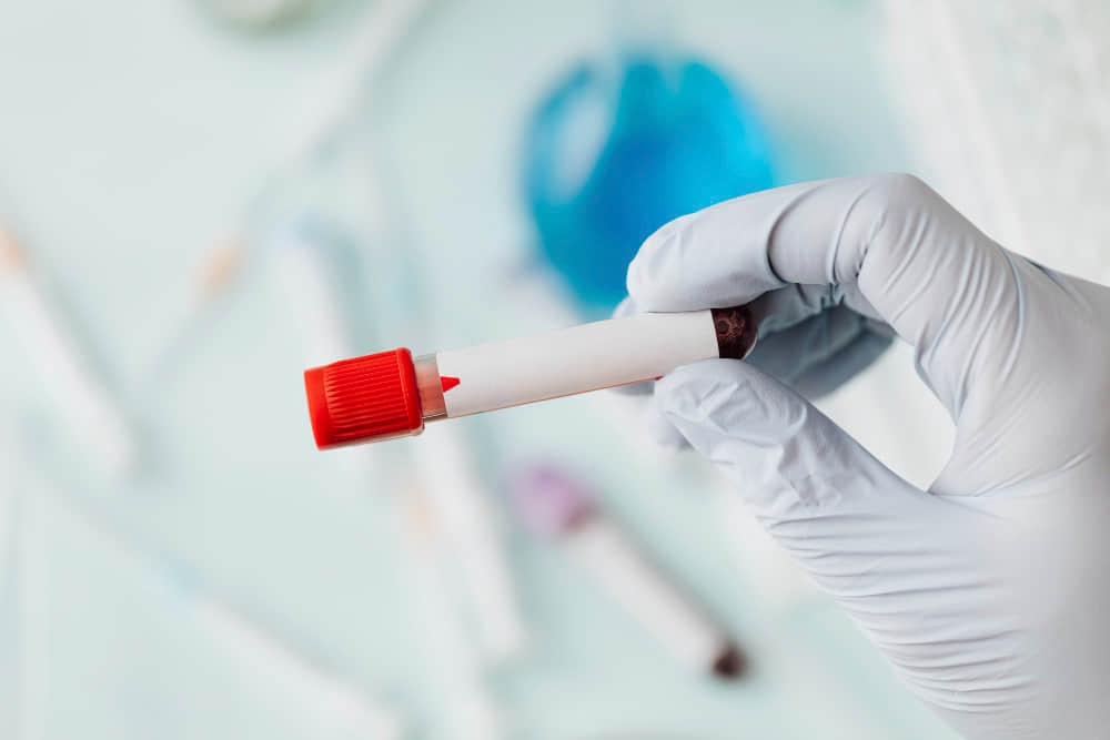 全球第 6 位 HIV 患者幾近痊癒! 科學家驚:「至今已逾一年半未復發。」-NICEOLO