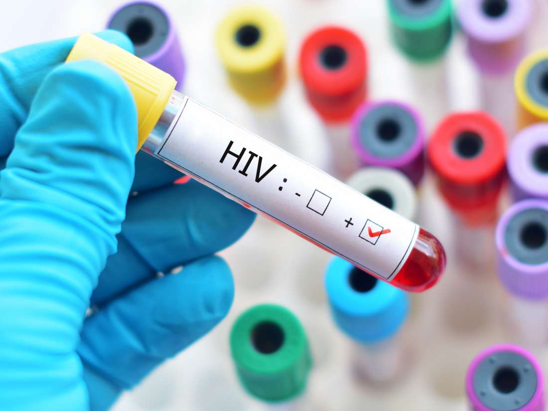 醫生憂 HIV 汙名化:患者病毒量低到不具傳染力,但他們仍擔心…-NICEOLO